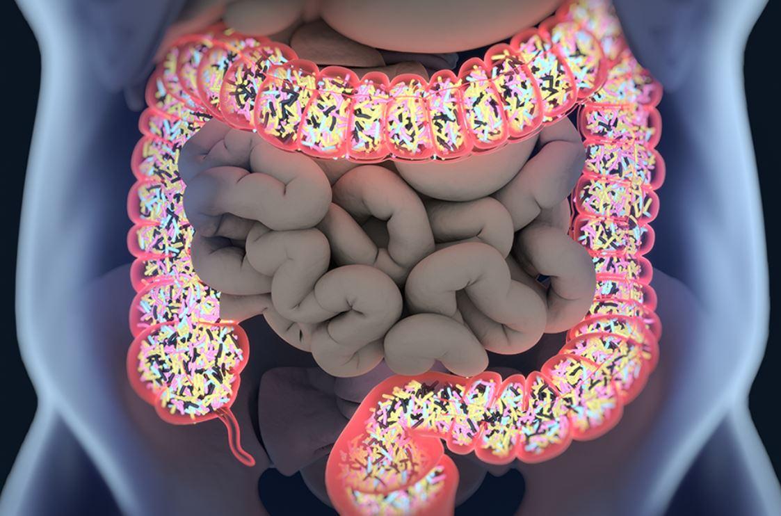 Microbiota intestinal, clave en la relación entre obesidad y cáncer colorrectal ...